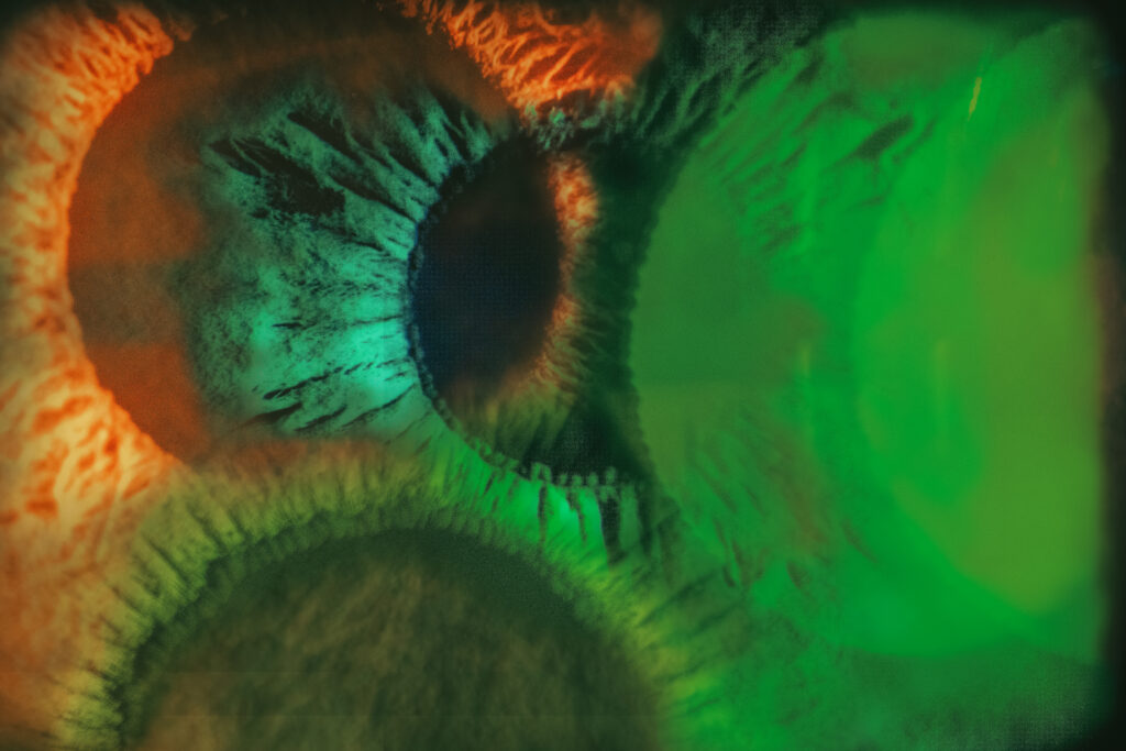 김재찬, 〈Microcosm in the Eye〉, 2025, Inkjet print, 36.6x50cm